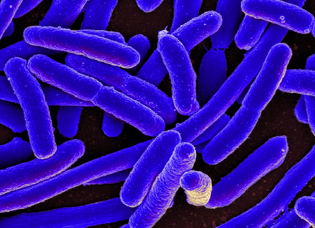 NIAID&nbsp;/ CC BY 2.0
A team of researchers from École Polytechnique Fédérale de Lausanne in Switzerland discovered bioengineered E. coli’s ability to generate electricity and consume organic waste at the same time.&nbsp;