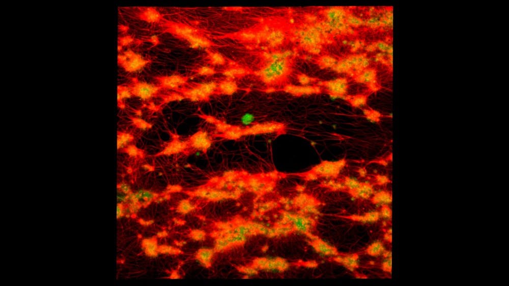MITCHELL/CC-BY-2.0
Titanium repels blood, limiting blood contact with surface to prevent clotting.
