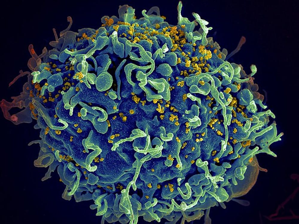 scanning-electron-micrograph-of-a-human-h9-t-cell-infected-with-hiv-virus-particles