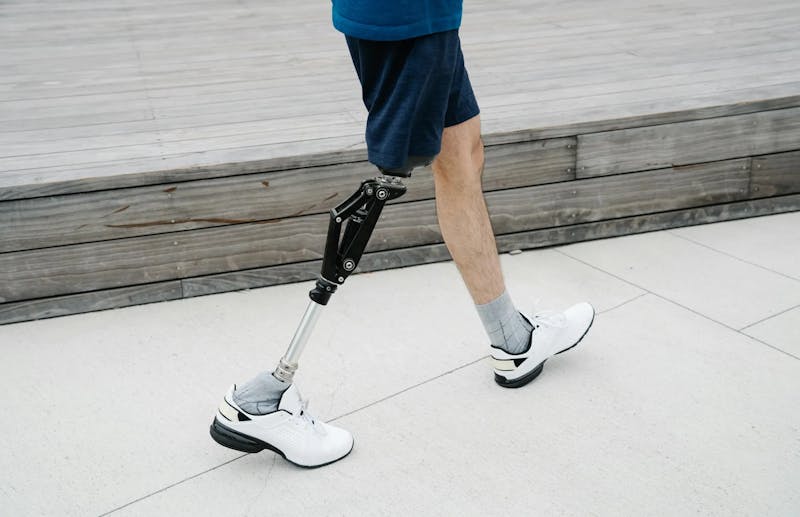 Revolutionizing prosthetics: Balancing power and passivity - The Johns ...