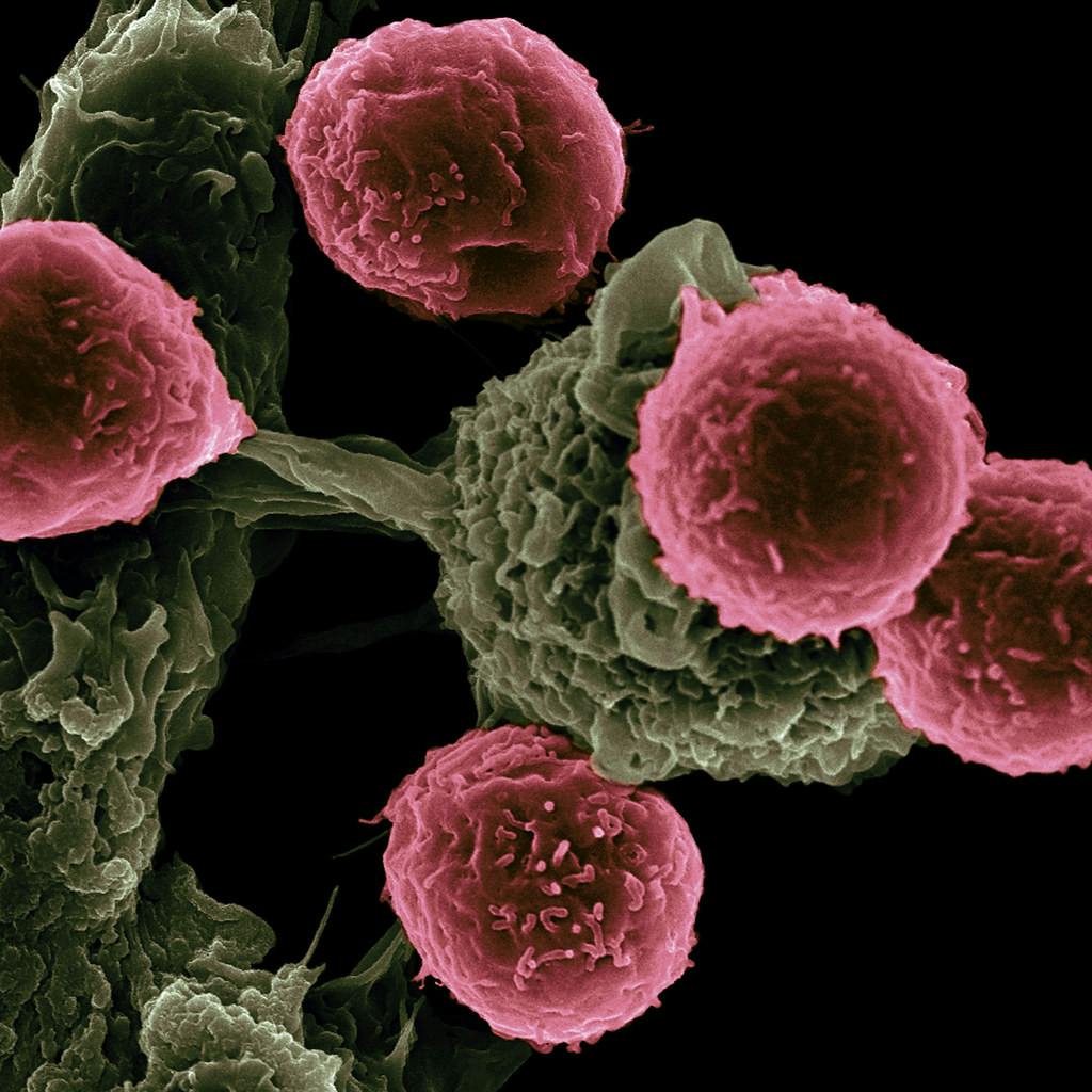 NIH IMAGE GALLERY / CC BY-NC 2.0
Immunotherapy is seen as a potential treatment to cancer, yet obstacles persist.&nbsp;