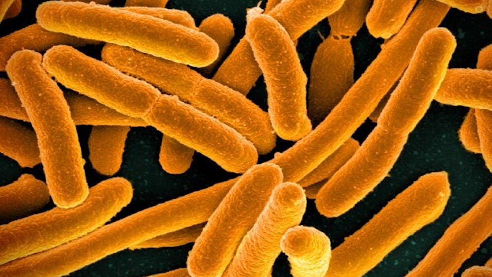 NIAID/cc-by-2.0
Quantum dots made out of metal nanoparticles may be the solution in the fight against superbugs.