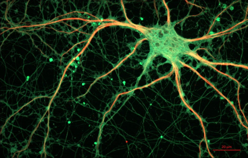 B9_neuron