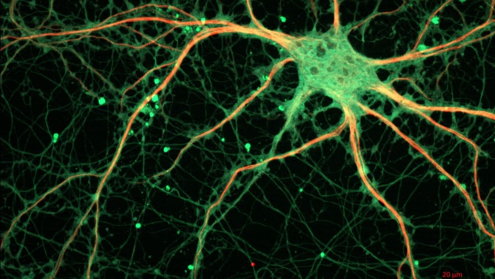 PUBLIC DOMAIN
Researchers at the Allen Institute have discovered new human neurons called “roseship cells.”
