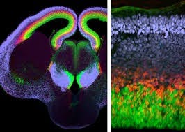 depts.washington.edu
The cerebral cortex of the brain is composed of several distinct cell layers. 