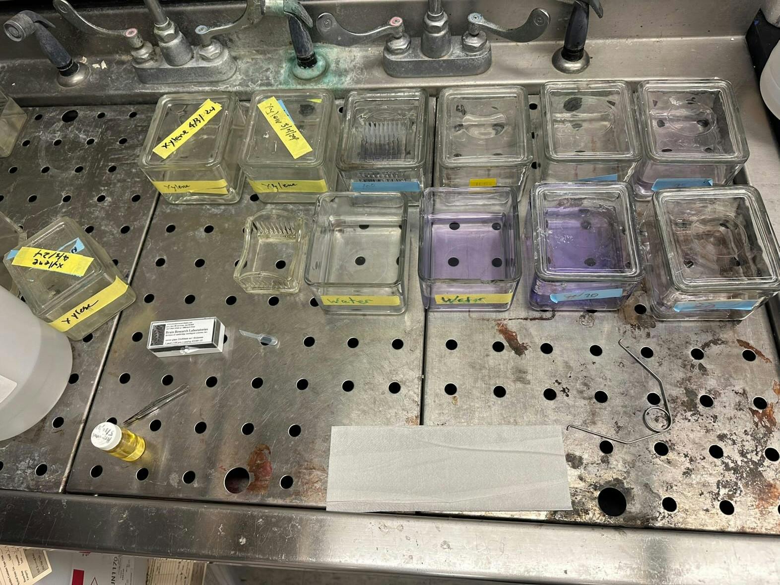 COURTESY OF BECKY ZHENG
In an interview with The News-Letter, sophomore Becky Zheng discusses her research experience at Hopkins.&nbsp;