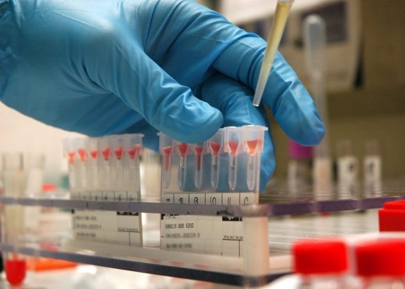 Hopkins creates blood test for cancer screening The Johns Hopkins