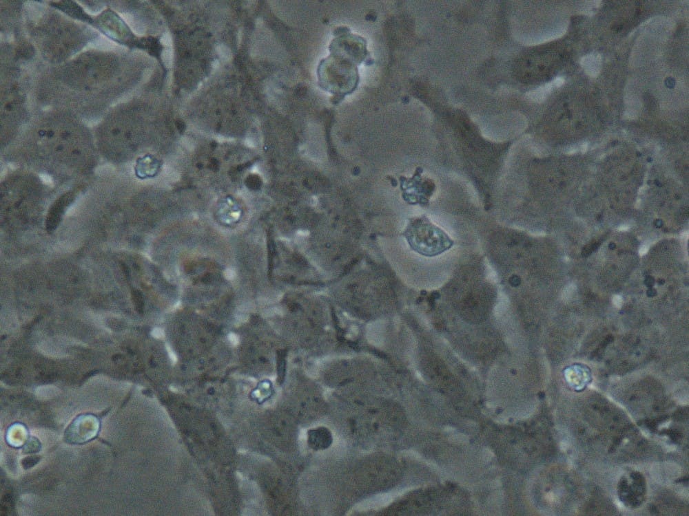  JOSEPH ELSBERND/CC BY-SA 2.0
 Neural stem cells could one day help cure diseases.