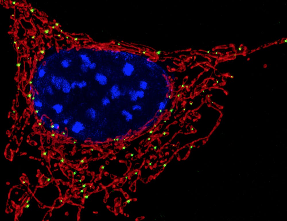 NICHD/cc-by-2.0
Mitochondria (shown in red) are typically inherited from the mother. 
