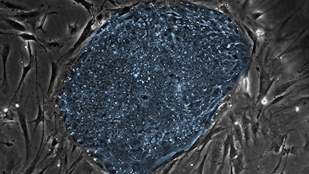 NIGMS IMAGE AND VIDEO GALLERY / CC BY NC-SA 3.0
A new treatment for LCSD involves using stem cells to develop mature corneas for corneal transplants. 