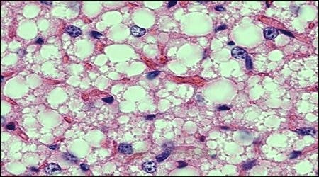 COURTESY OF WWW.VIVO.COLOSTATE.EDU
According to the study, the neurotransmitter GABA mediates the expenditure of energy from brown fat.