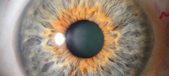 COURTESY OF WWW.UCDMC.UCDAVIS.EDU
Complexities in nature may have evolved towards simpler structures. 