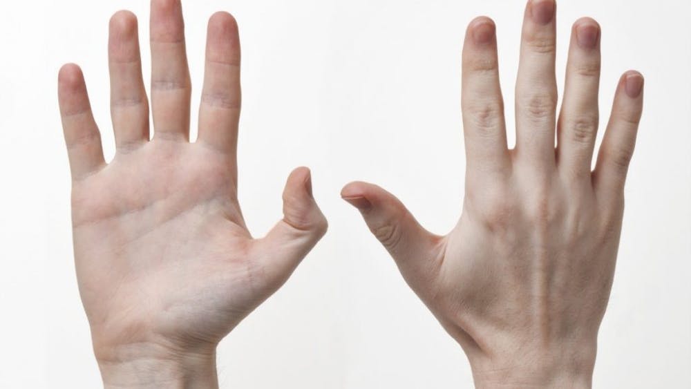  Evan/CC-BY-SA-3.0
The smaller the index-to-ring finger ratio the greater the amount of testosterone present.
