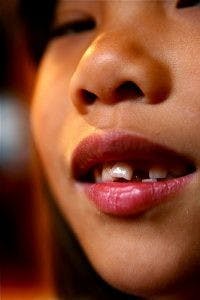  Public Domain
Crooked teeth are connected with environmental stress early in life.