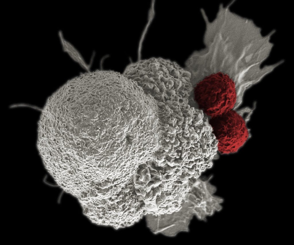 NIH Image Gallery / CC BY-SA 2.0
Researchers at the Sidney Kimmel Comprehensive Cancer Center identified a subset of macrophages that interact closely with breast cancer cells responsible for metastasis.&nbsp;