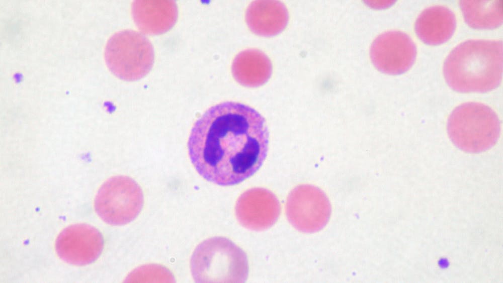 COURTESY OF ED UTHMAN / CC BY 2.0
Autoimmunity occurs when the body’s immune system attacks itself.