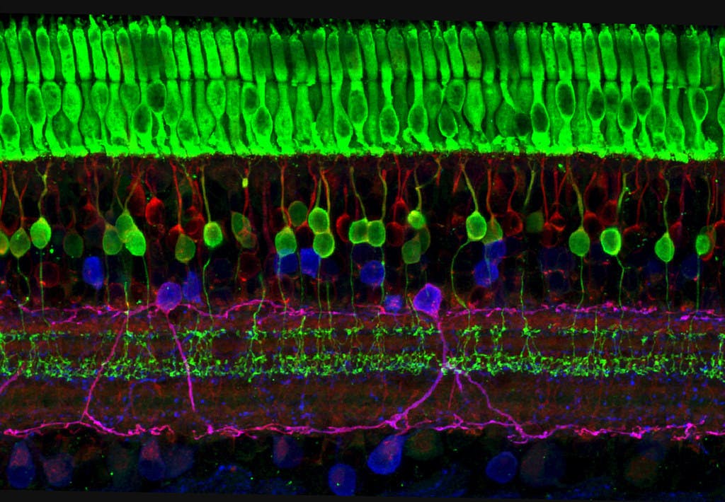NIH IMAGE GALLERY / PDM 1.0
Kiara Eldred shared her novel technique CUT&amp;TIME for studying cell differentiation in retinal cells.&nbsp;
