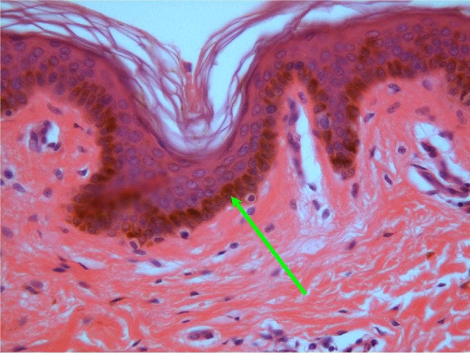 COURTESY OF WWW.VICTORIACOLLEGE.EDU
In addition to examining promoters in brain regions, researchers used the software to identify possible gene promoters in melanocytes (skin cells).