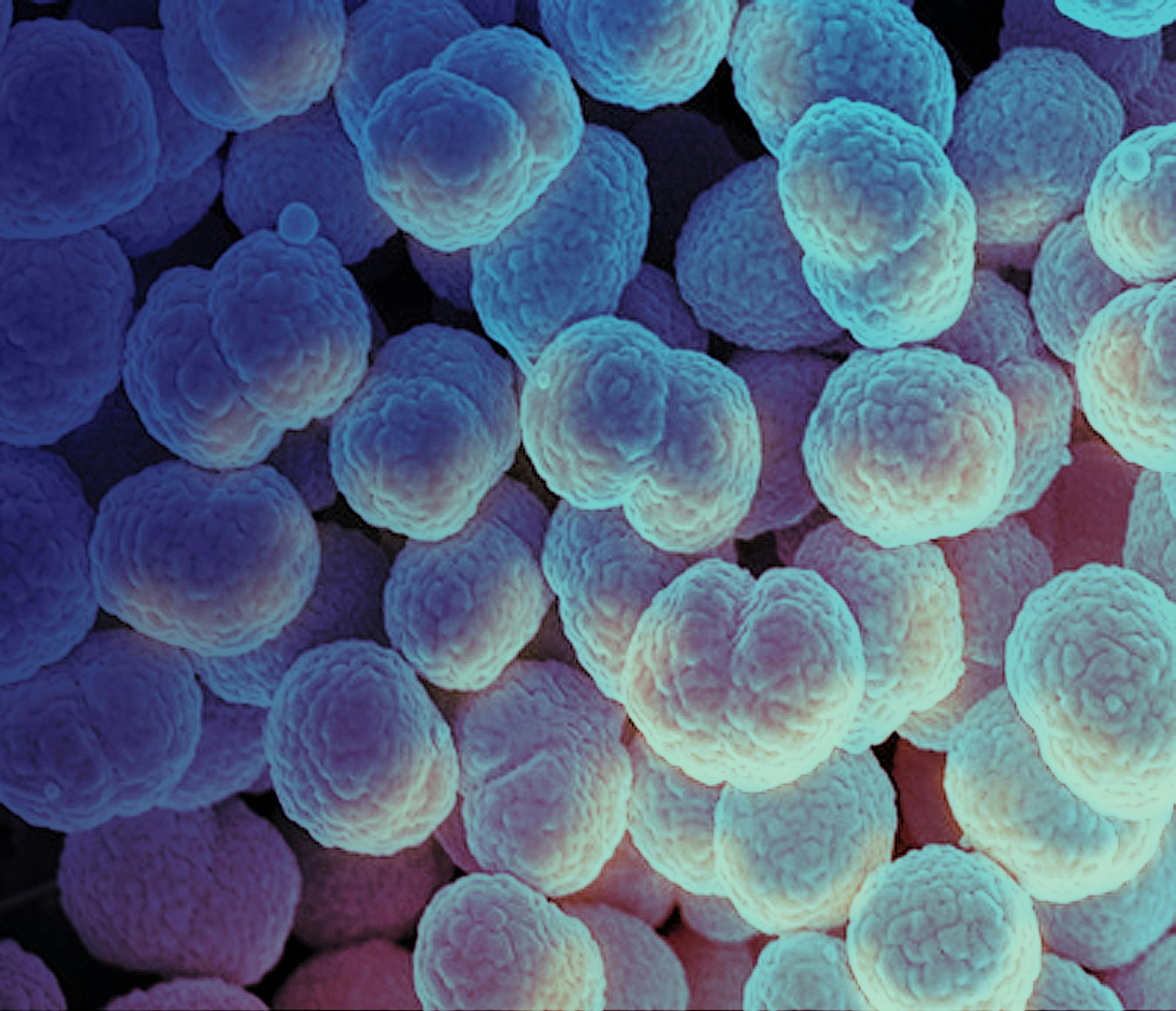 NIAID / CC BY 2.0
A new drug can treat patients with the antimicrobial-resistant strain of N. gonorrhoeae, a bacteria that causes the sexually transmitted disease gonorrhea.&nbsp;