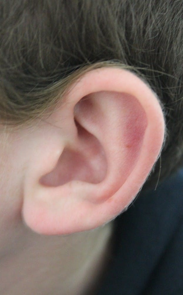 PUBLIC DOMAIN
Researchers recently developed a drug that can protect the cochlear cell line.