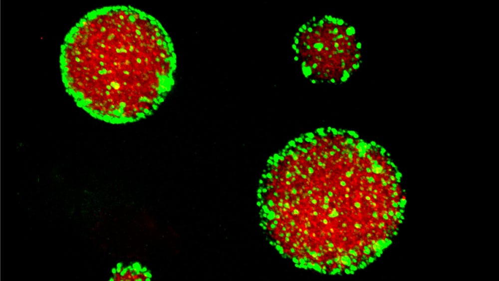 COURTESY OF ANDREW FOLKMANN
Liquid protein condensates (red) are stabilized by Pickering agents (green) that adsorb to the condensate surface.