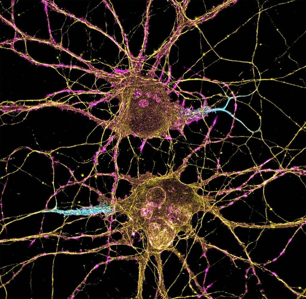 NIH IMAGE GALLERY&nbsp;/ CC BY-NC 2.0
Hu shares her experiences as an undergraduate researcher in a lab studying neurotransmitter receptor function and synaptic transmission.&nbsp;