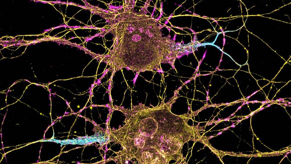 NIH IMAGE GALLERY&nbsp;/ CC BY-NC 2.0
Hu shares her experiences as an undergraduate researcher in a lab studying neurotransmitter receptor function and synaptic transmission.&nbsp;