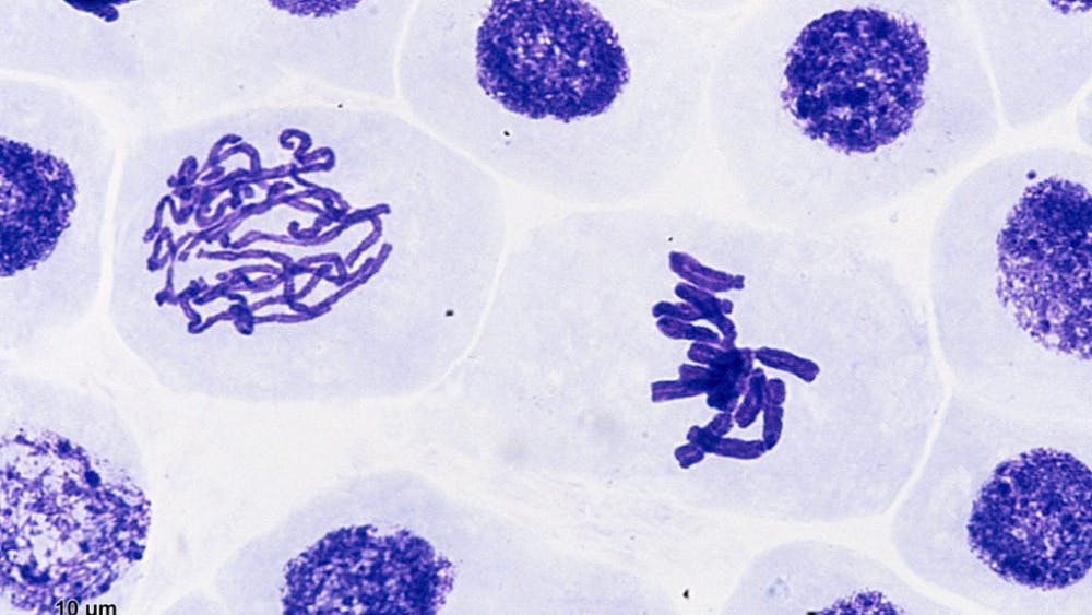  DR. JOSEF REISCHIG/CC-BY-SA-3.0
Chromosomes (the dense, purple clumps) may contain less DNA than previously thought.