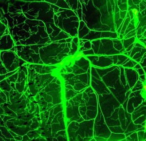 [Improvision Data]ImageName=TimeStampMicroSeconds=3274280822489000TimeStamp=11:27:02.489 on Oct 03, 2007ChannelName=GFPChannelNo=1TimepointName=1TimepointNo=1ZPlane=1BlackPoint=0WhitePoint=255WhiteColour=255,255,255XCalibrationMicrons=1YCalibrationMicrons=1ZCalibrationMicrons=1TotalChannels=1TotalTimepoints=1TotalZPlanes=1TotalZPlanes=1SampleUUID=73cae7e9-dd25-4d34-a75b-94ed7b89e21a