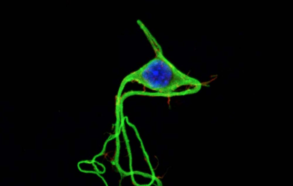  xpanzion/CC-By--SA-3.0
Salleo made an artificial synapse.