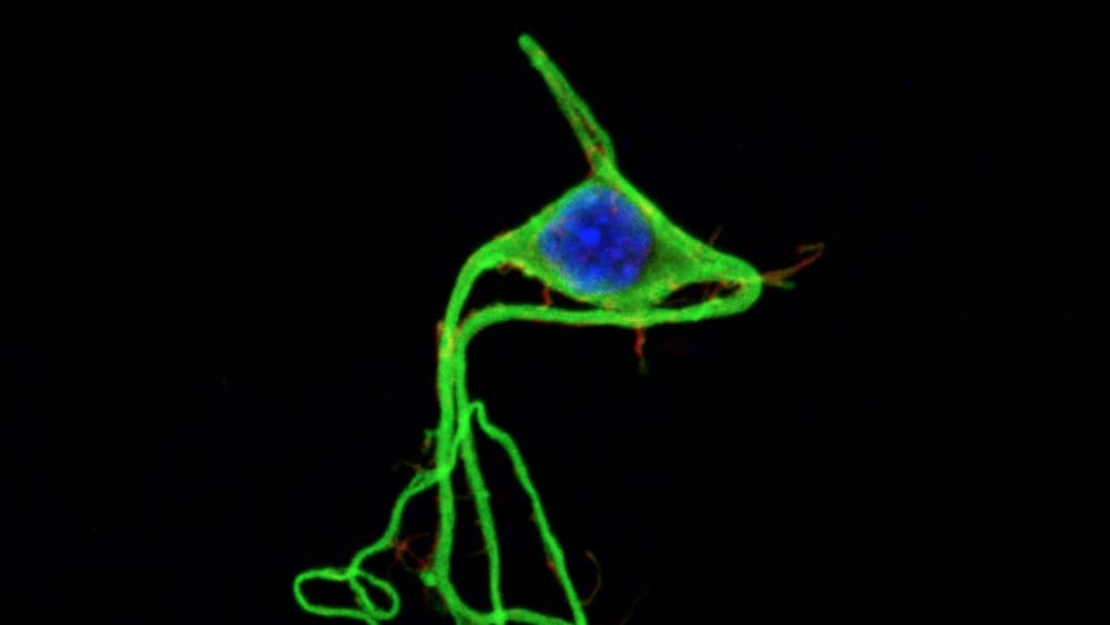 xpanzion/CC-By--SA-3.0
Salleo made an artificial synapse.