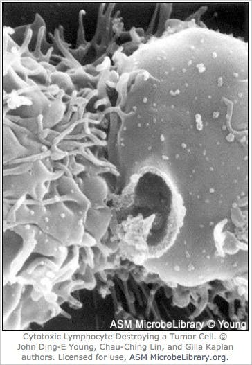 depts.washington.edu
Immune system cells are rendered useless by clever cancer cells.  