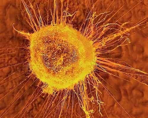 COURTESY OF WWW.CHEMO.NET
Women have two copies of BRCA1, which may mutate to cause cancer.