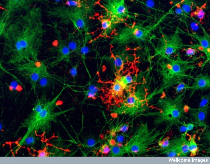 B0006485 Astrocytes and oligodendrocytes from neural stem cells
Credit: Yirui Sun. Wellcome Images
images@wellcome.ac.uk
http://images.wellcome.ac.uk
Astrocytes (green) and oligodendrocytes (red) derived from rat neural stem cells in culture. Both these cells are types of neuroglia and are important for correct brain function.
Confocal micrograph
2006 Published:  - 

Copyrighted work available under Creative Commons by-nc-nd 2.0 UK, see http://images.wellcome.ac.uk/indexplus/page/Prices.html