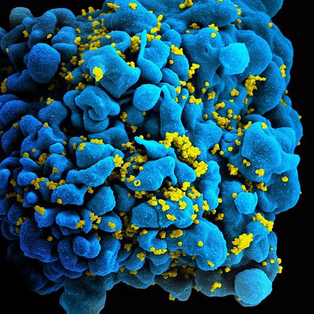 NIAID / CC BY 2.0
New discoveries in HIV research have renewed hope for the development of an HIV vaccine.&nbsp;