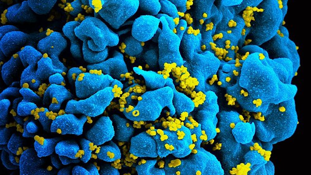 NIAID / CC BY 2.0
New discoveries in HIV research have renewed hope for the development of an HIV vaccine. 