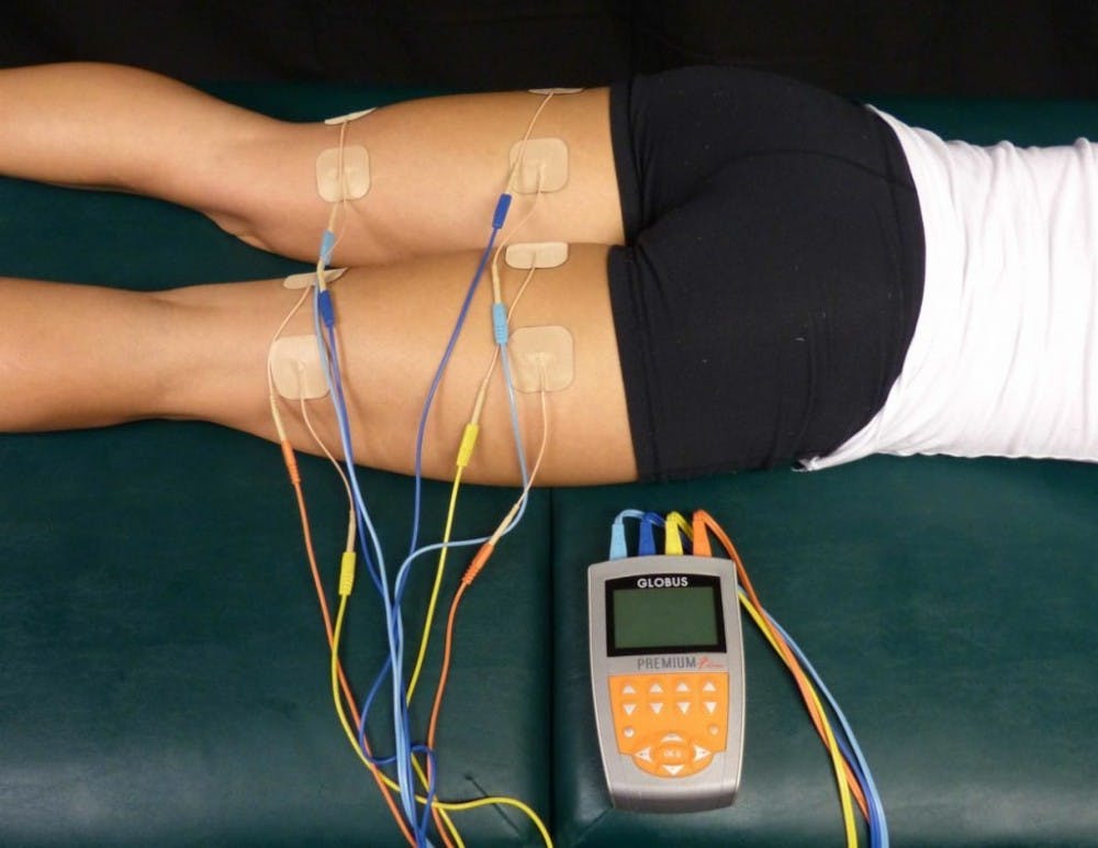  GCIRIANI/CC-BY-SA-4.0
Intrafasicular multielectrode stimulation can help stimulate fatigue-resistant muscles.