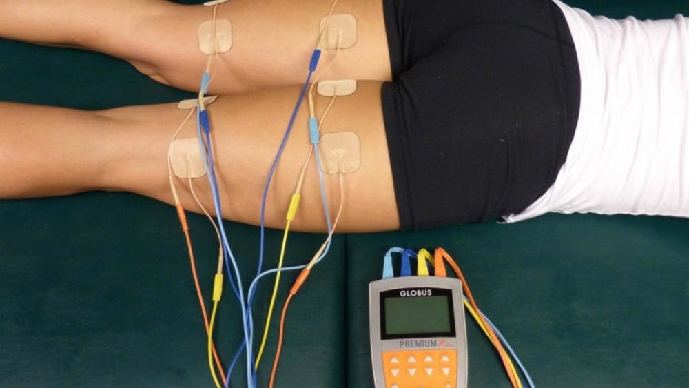 GCIRIANI/CC-BY-SA-4.0
Intrafasicular multielectrode stimulation can help stimulate fatigue-resistant muscles.
