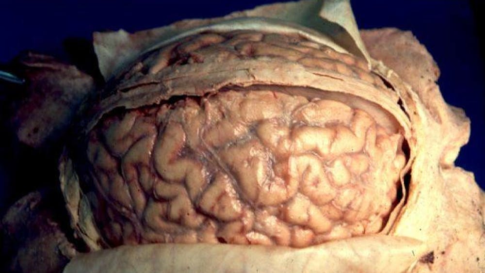 JOHN A BEAL/CC-BY-2.5
Human cortical folding is universal.