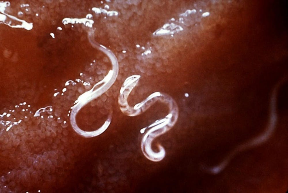  PUBLIC DOMAIN
Roundworms were used as models to detect the signaling pathway for fat metabolism.