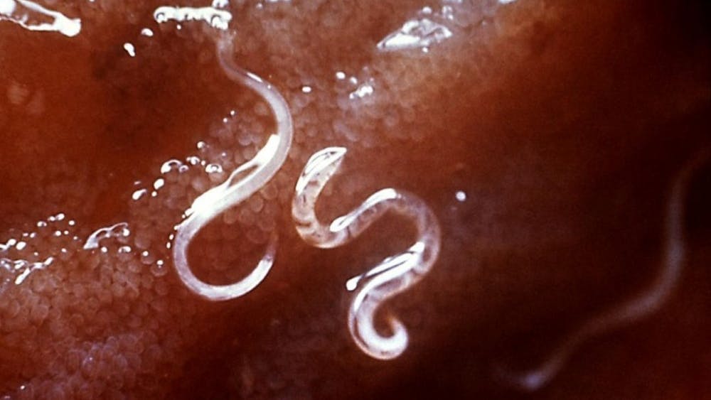 PUBLIC DOMAIN
Roundworms were used as models to detect the signaling pathway for fat metabolism.