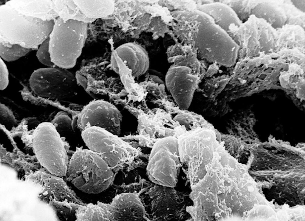 <p><em>Laboratory worker at anti-plague research facility in Siberia died amid concerns over pneumonic plague. (Photo courtesy of </em><a href="https://commons.wikimedia.org/wiki/File:Yersinia_pestis.jpg" target=""><em>Wikimedia Commons</em></a><em>)</em></p><p><br/><br/></p>