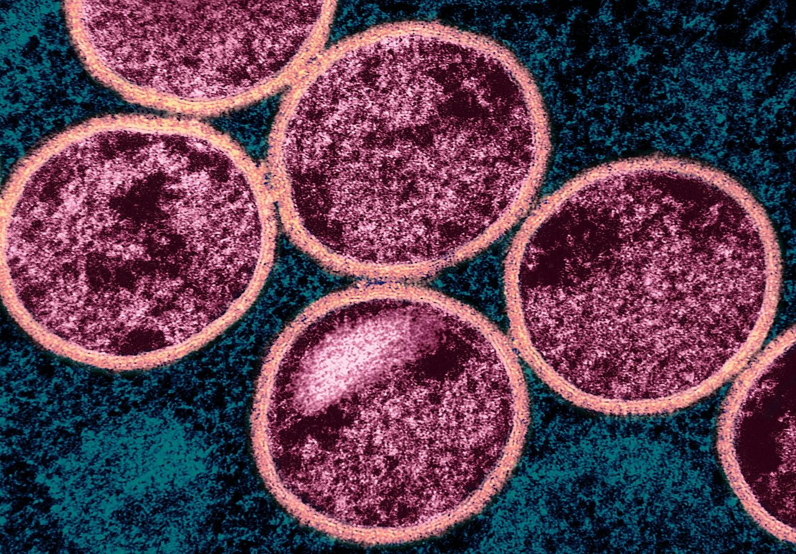 Monkeypox is a viral disease that can readily transmit to infected animals and humans (Photo courtesy of Wikimedia Commons / “Mpox Virus - 53848137961” by NIAID. July 26, 2024). 