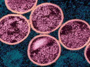 Monkeypox is a viral disease that can readily transmit to infected animals and humans (Photo courtesy of Wikimedia Commons / “Mpox Virus - 53848137961” by NIAID. July 26, 2024).