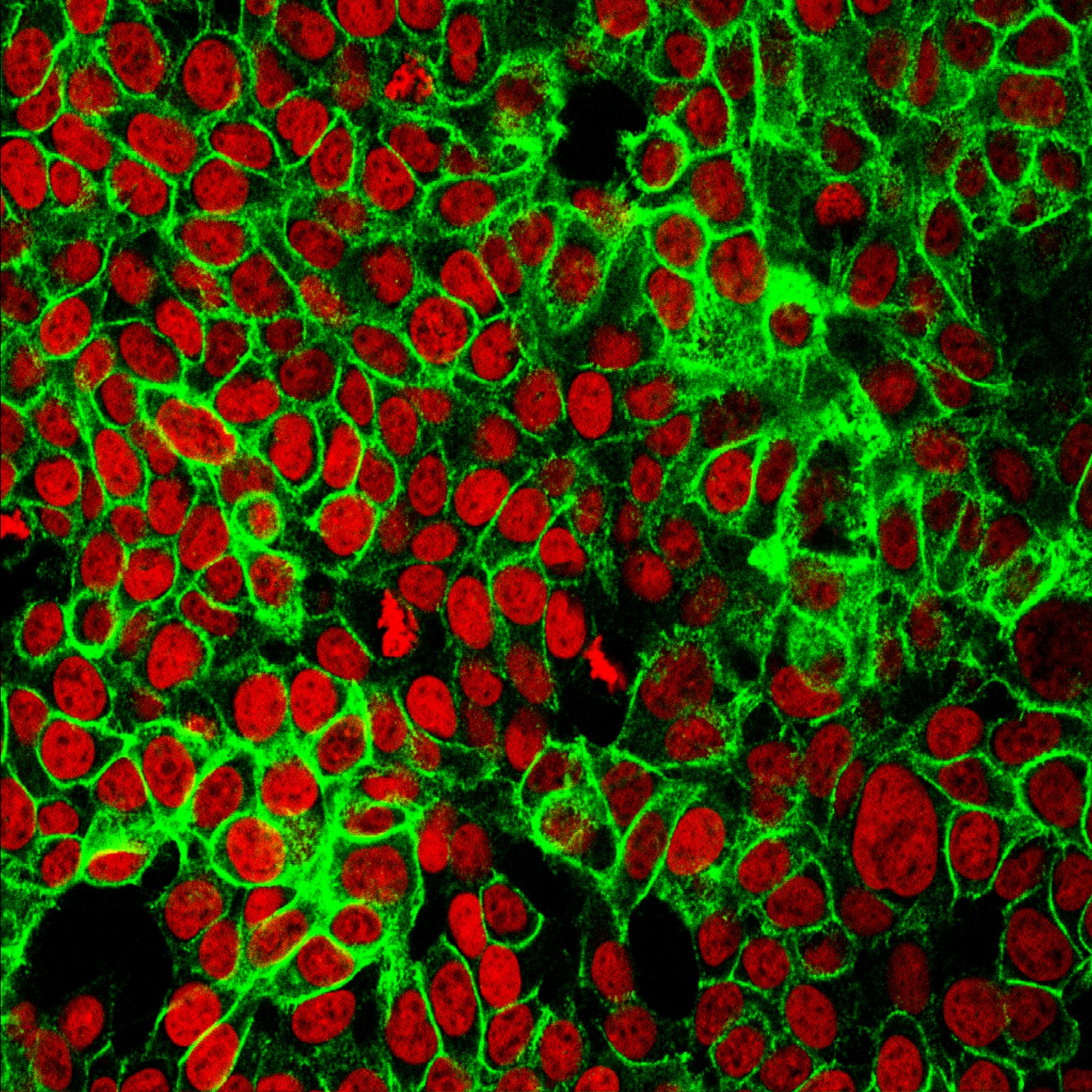 Researchers from the University of California San Francisco believe they have found a new way to treat a specific mutation in some cancers through immunotherapy. (Flickr/Human Colon Cancer Cells by NIH Image Gallery)