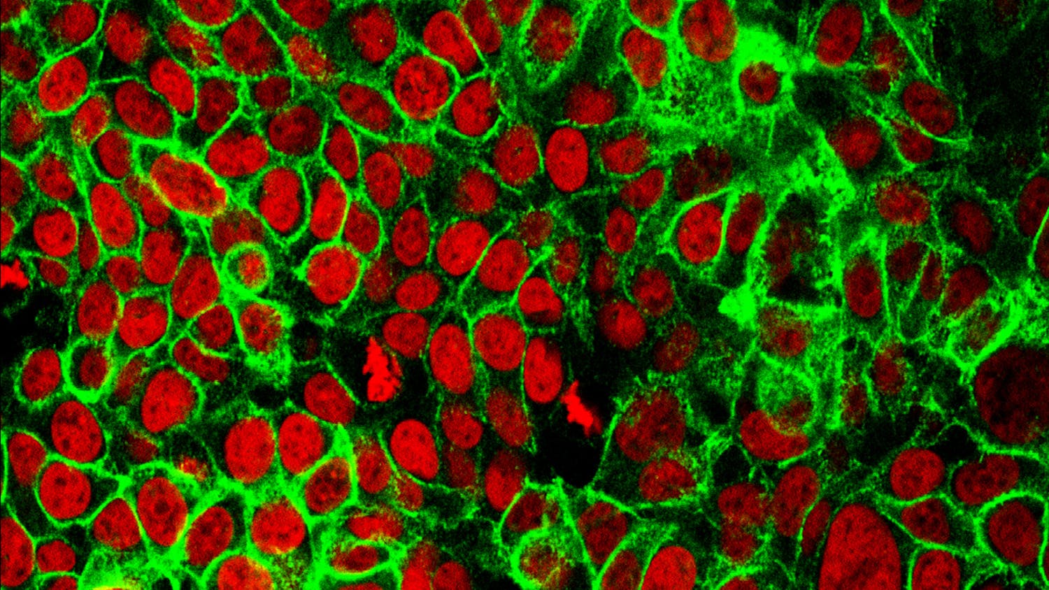 Researchers from the University of California San Francisco believe they have found a new way to treat a specific mutation in some cancers through immunotherapy. (Flickr/Human Colon Cancer Cells by NIH Image Gallery)