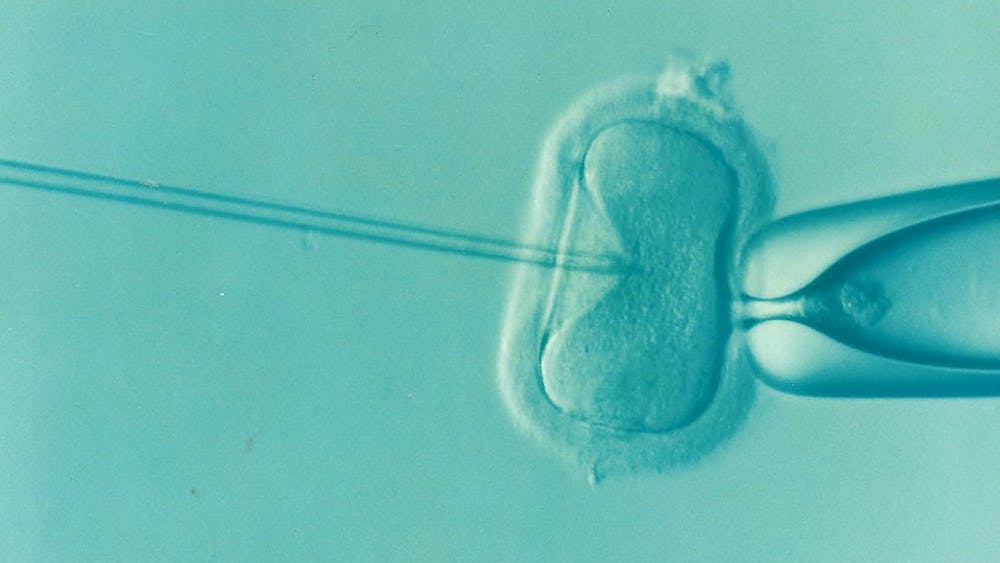 <p><em>Since the Alabama IVF ruling, health systems around the state have paused their in-vitro fertilization treatments, impacting hundreds of families across the state (Photo courtesy of </em><a href="https://commons.wikimedia.org/wiki/File:Ivf.png" target=""><em>Wikimedia Commons</em></a><em> / DrKontogianniIVF. July 14, 2016). </em></p>
