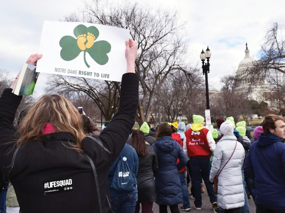 1485738200-e0a7630794e436f