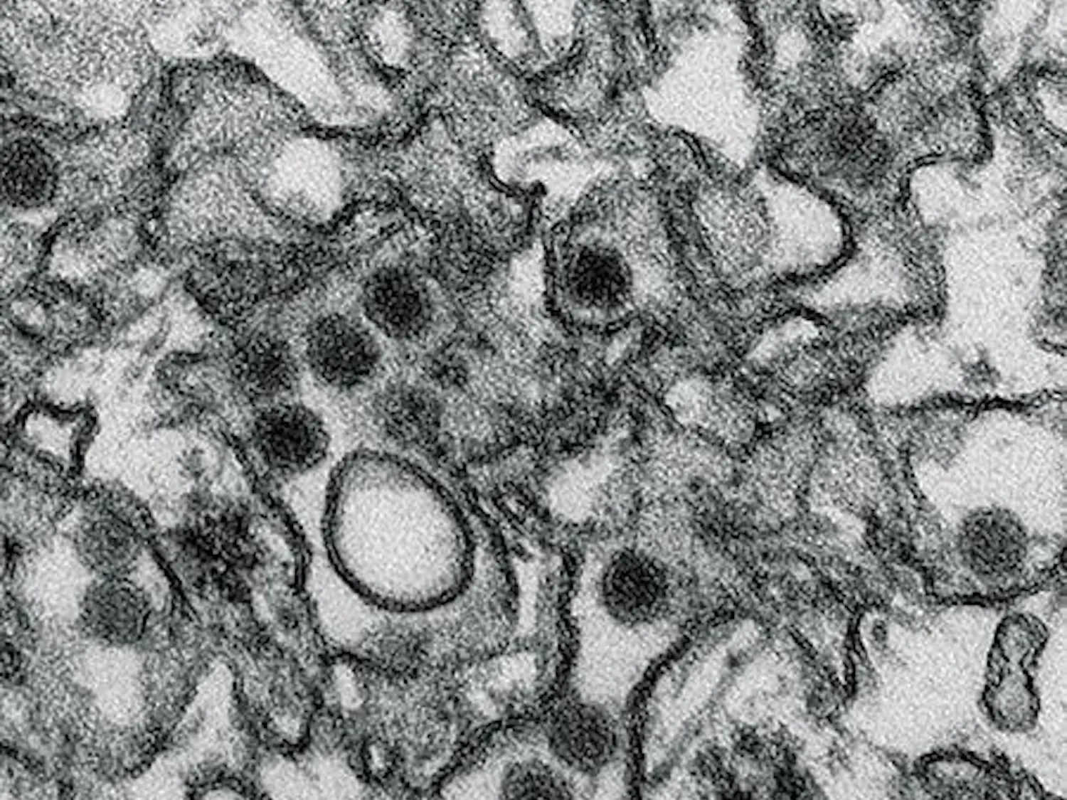 Zika Virus
