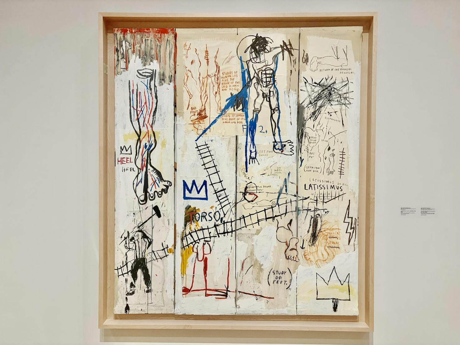 A painting composed of four panels with white painted backgrounds, anatomical models, and railroad tracks sketched around it hangs on a white wall. 